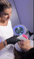 SMAS Lifting for Alma by Dr.Milena