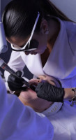Fotona 4D® - Fotona-4d-for-story